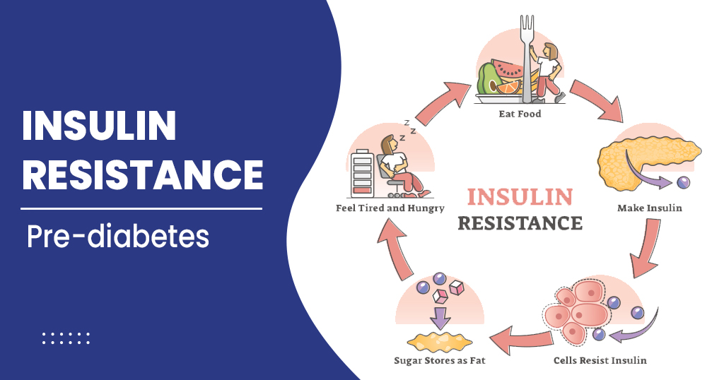 Insulin Resistance And Diabetes Slimming Center In Pune